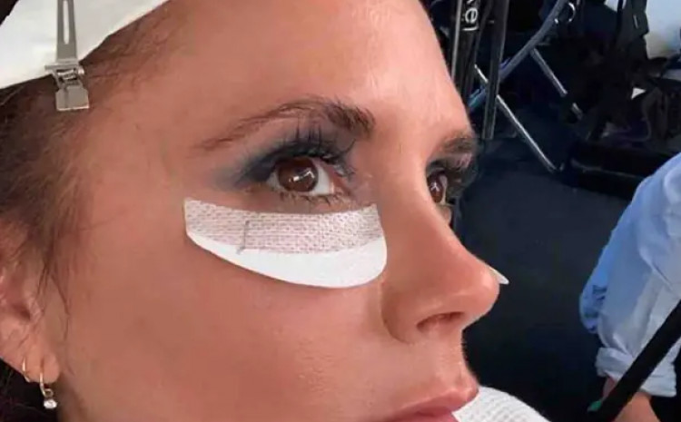 Plastični hirurzi o zvijezdama: Peglaju se u koroni, da niko ne bi skontao