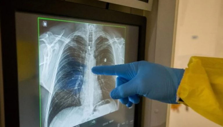 SVJETSKI MEDIJI TVRDE: Pojavio se novi virus, bolest opasnija od korone