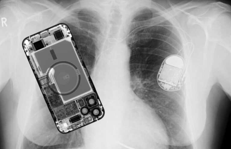 Apple potvrdio da je iPhone 12 potencijalna opasnost za pacemakere