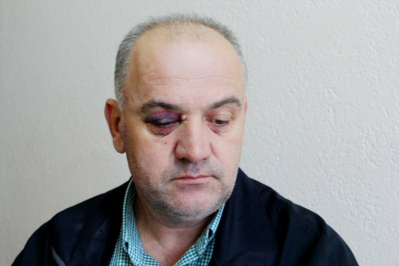 Napadnut i ozlijeđen predsjednik sindikata JKP “Vodovod” Bugojno
