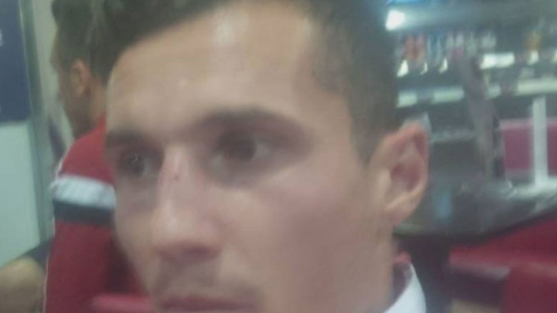 543e6e13-14ec-4ca1-a913-13f6b0765237-albanski-igraci-povrede11