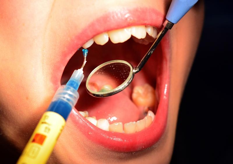 Evo kako ukloniti zubni kamenac prirodnim putem