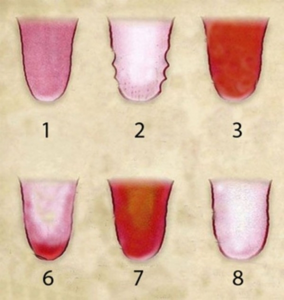 Deset promjena na jeziku otkriva kakvog ste zdravlja