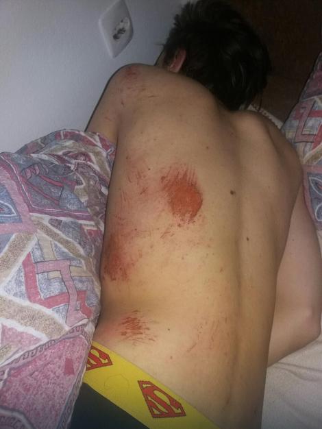 Narkodileri brutalno pretukli mladića iz Teslića!