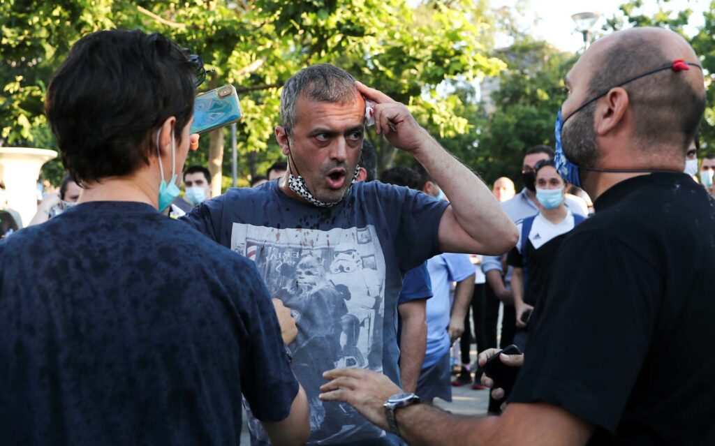 2020 07 08T175114Z 342408583 RC25PH960L42 RTRMADP 3 HEALTH CORONAVIRUS SERBIA PROTESTS