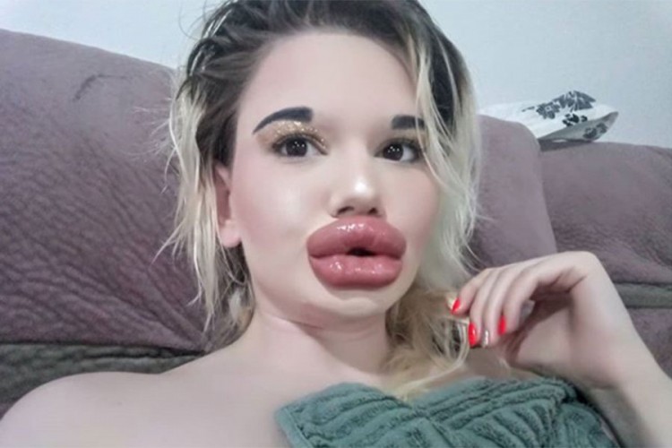 20201001141832 624125