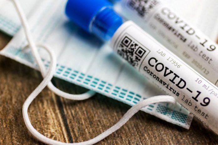 Osobe s lakšom kliničkom slikom neće biti testirane