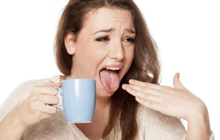 Evo šta treba da radite kada “opržite” jezik