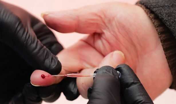 Stručnjaci tvrde da su serološki testovi nepouzdani za utvrđivanje imuniteta