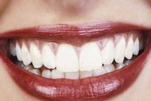 20210211224547 645917