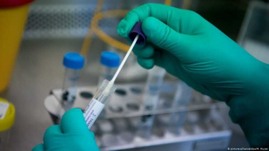 koronavirus test lazni januar 2021