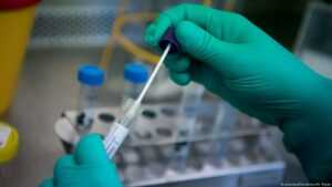koronavirus test lazni januar 2021