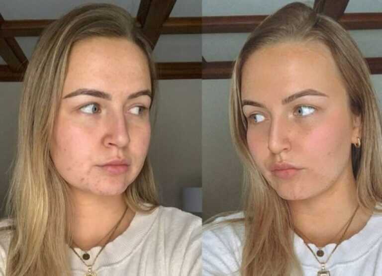 Kako bez filtera izgledaju ljepotice sa Instagrama