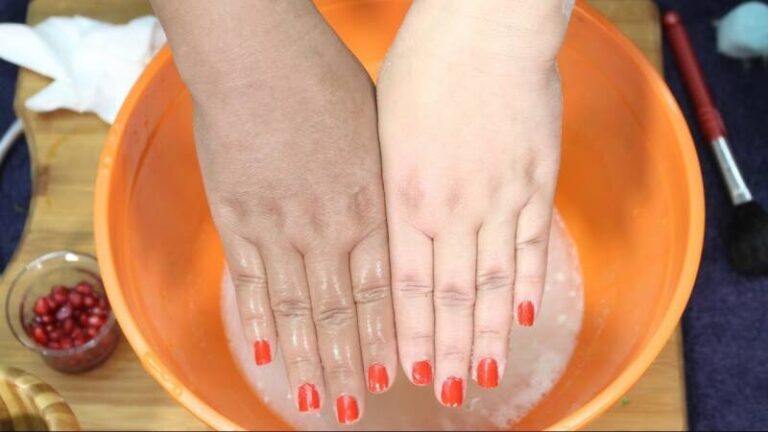 Žena u videu pokazala kako uz pomoć namirnica iz kuhinje ukloniti staračke pjege s ruku