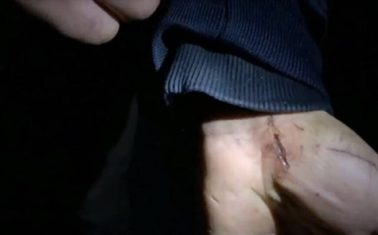 Ispovijest Afganistanke: Policajac u Hrvatskoj me tukao, skinuo i drirao po grudima