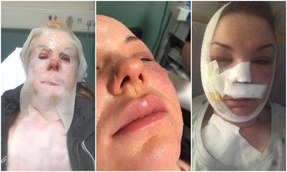 viralni trik posirana jaja prtscr