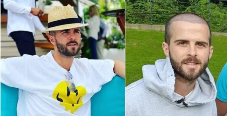 I Miralem Pjanić transplantirao kosu, koliko ovaj zahvat košta u Bosni i Hercegovini?