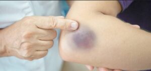 modrice ljekari 12 696x329 1