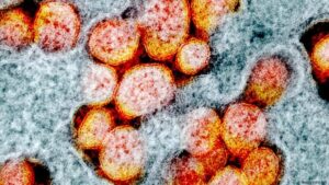 koronavirus covid19 sarscov2 celije DW