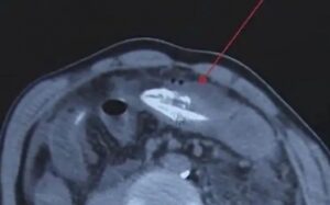 325ef4a94243e3b86bd4cad332ebf3fd