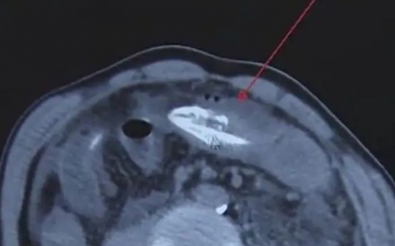 325ef4a94243e3b86bd4cad332ebf3fd