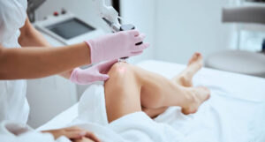 prosirene vene prvo zdravlje