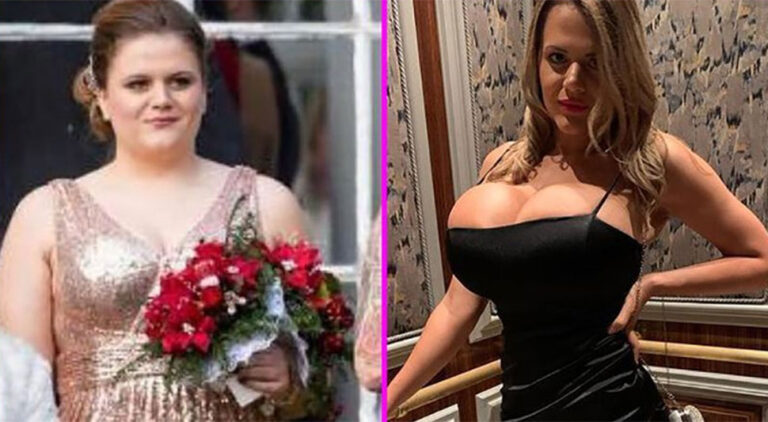 Ismijavana zbog izgleda, a onda je uložila 35.000 evra u operacije