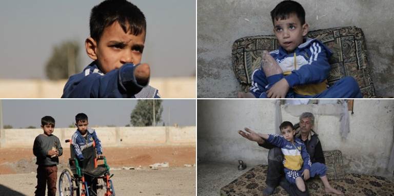 Šestogodišnji dječak koji je izgubio ruku i nogu u napadu Assadovog režima sanja da dobije proteze