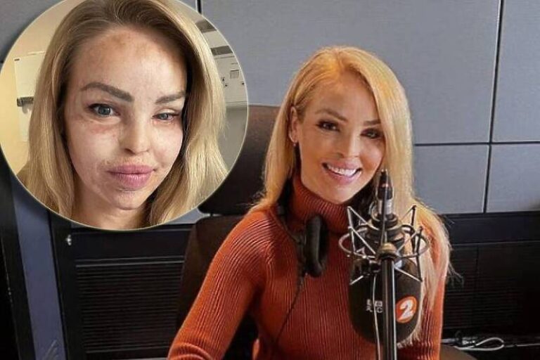 Voditeljica koju je bivši dečko polio kiselinom: Kćerka se plašila da je dodirnem