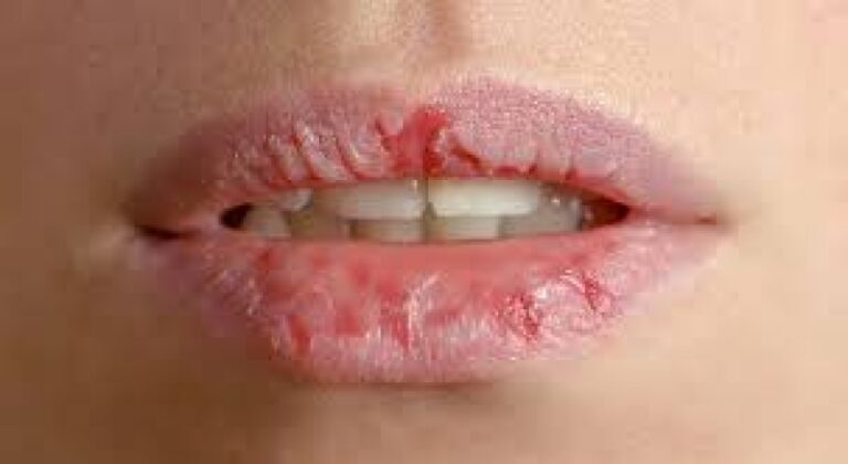 Radnici Agencije za lijekove BiH iduće sedmice stupaju u štrajk; Rustemović: Bit će problema u snabdijevanju lijekova