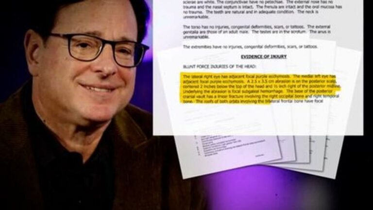 Izvještaj o obdukciji pokrenuo lavinu pitanja: Kako je zapravo umro slavni glumac?