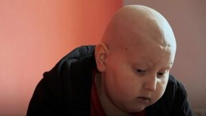 djeca oboljela rak bbc 696x395 1