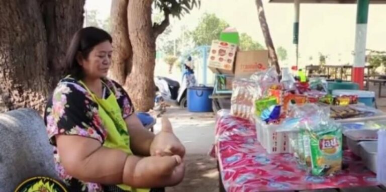 Ova žena godinama nije izlazila iz kuće od sramote: Doktori ne mogu da joj pomognu