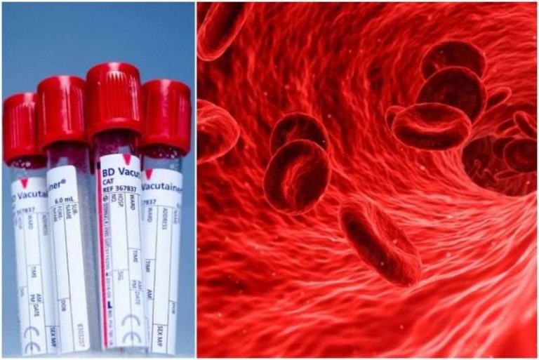 Koje krvne grupe su sklonije infarktu i srčanim bolestima