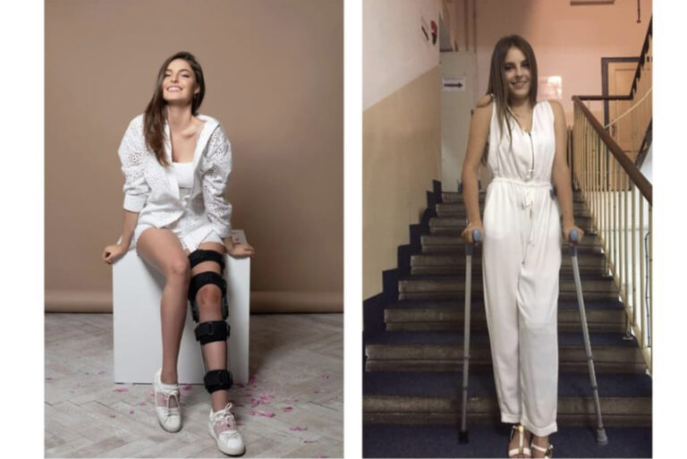 Džejla Ramović na štakama nakon operacije koljena