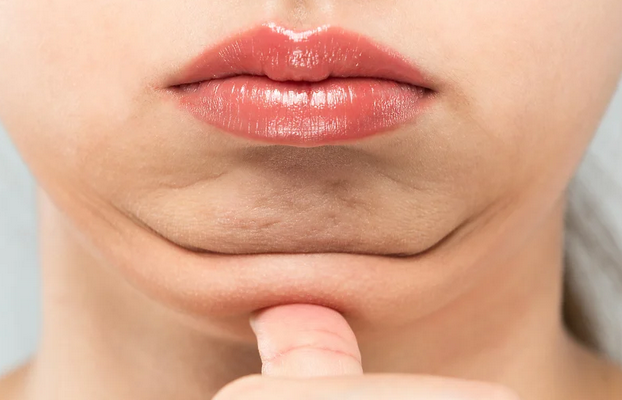 Riješite se podbratka uz ove tri jednostavne vježbe