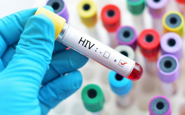 Zavod zdravstvenog osiguranja FBiH: Osiguran zamjenski lijek za liječenje zaraženih HIV-om