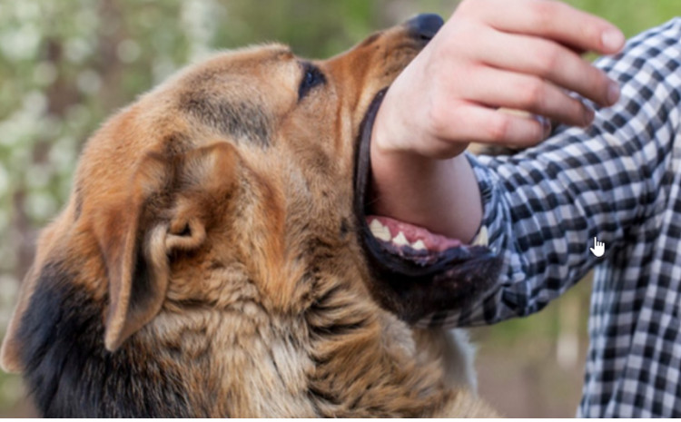 Teška sudbina čovjeka kog je mrtvog izujedalo 15 pasa