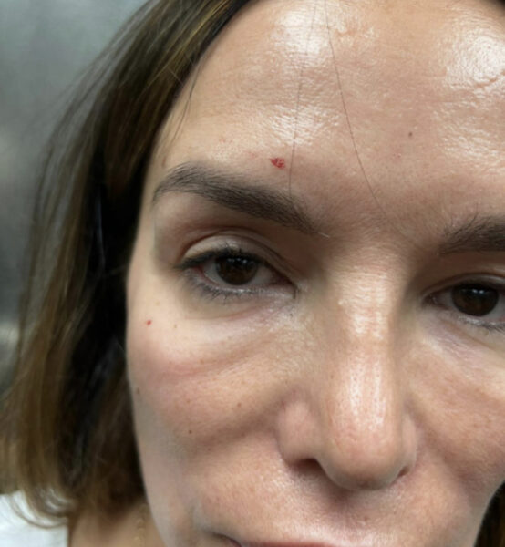 Da li je Severina na kraju žrtva napada: Pojavile se prve fotografije povreda pjevačice