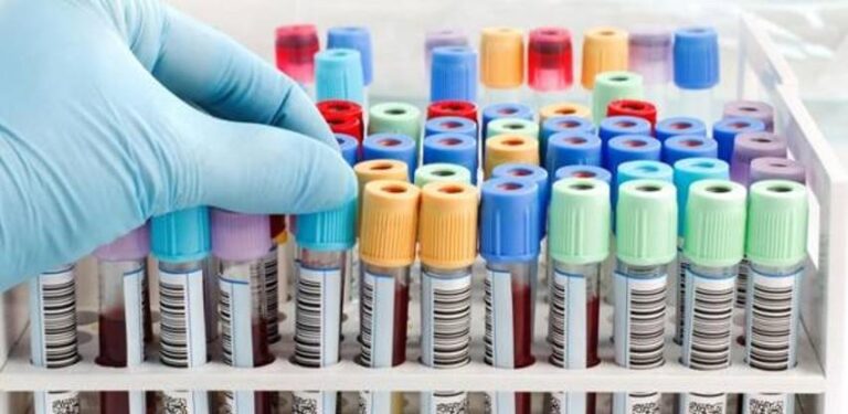 U BiH su još uvijek 332 tone zabranjenog polikloriranog bifenila