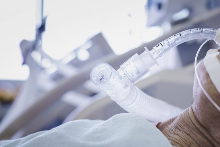 COVID-19 je doveo pacijenta u bolnicu, ali je infekcija izazvana upotrebom respiratora bila uzrok smrti