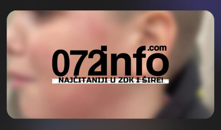 UŽAS U ZENICI: Dječak pretučen, davio ga, šutao… (FOTO)