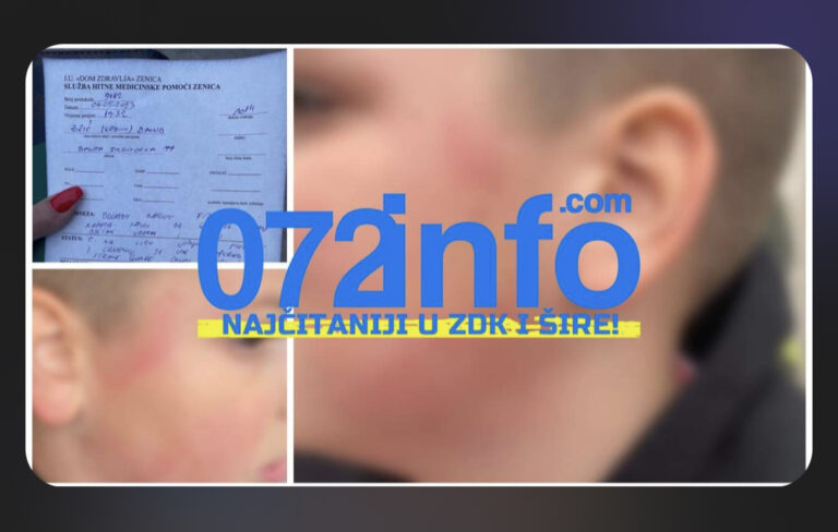 STRAVIČNI DETALJI NAPADA NA DJEČAKA U ZENICI: Mama, davio me i šutao…
