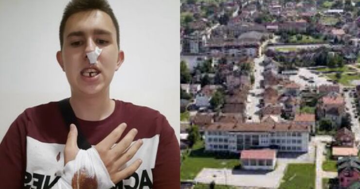 U Bratuncu povratnika bošnjačke nacionalnosti pretukla tri muškarca, izbili mu zub i nanijeli teže tjelesne povrede