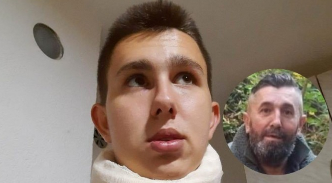 Otac pretučenog mladića iz Bratunca: Rekli su mu: “Klat ćemo vas kao ’95-te što smo vas klali”. Izboli su ga, slomili mu nos i izbili zub