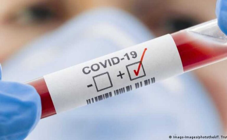 Stručnjaci tvrde: Otkriven novi ‘najekstremniji’ soj COVID-19