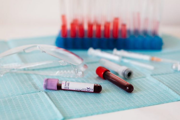 Nova krvna pretraga može za sat vremena otkriti uzrok temperature kod djece