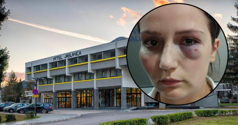 Da li je inspekcija nakon premlaćivanja Enise Klepo kontrolisala hotel u Jablanici?