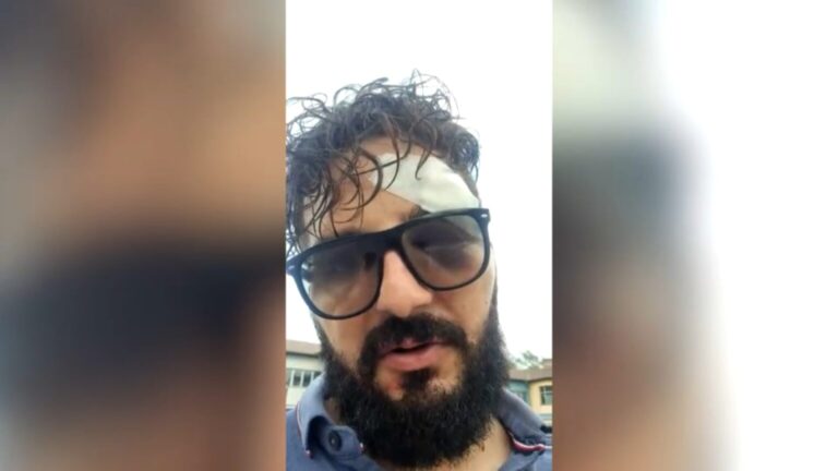 Brutalno pretučeni novinar: Imam devet šavova, ali sve sam zapamtio