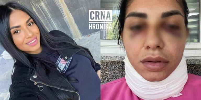 Dvojica muškaraca pretukli Amiru ispred Binga: Njena djeca sve to morala gledati